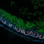 This microscopic image shows the bacterial pathogen C. rodentium (green) is covering the intestinal surface (blue) in mice.