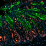 Study reveals role of “peacekeeper” in the gut