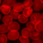 Red blood cells. Photo: Wikimedia Commons.