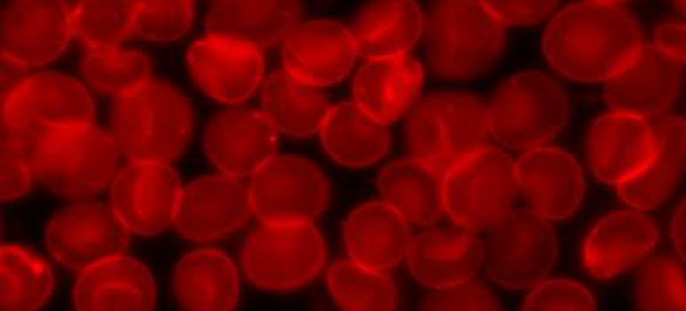 Sedimented_red_blood_cells 770