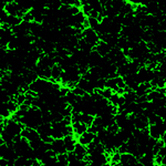 Microglia are part of a newly discovered mechanism that contributes to Alzheimer's disease.