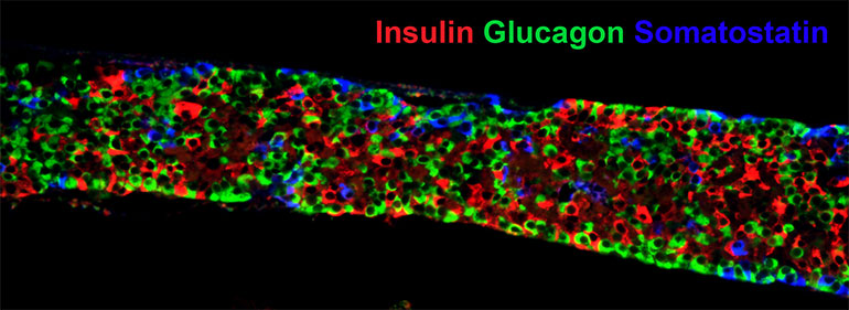 Insulin Glucagon Somatostatin.