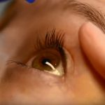 New glaucoma treatment could ease symptoms while you sleep