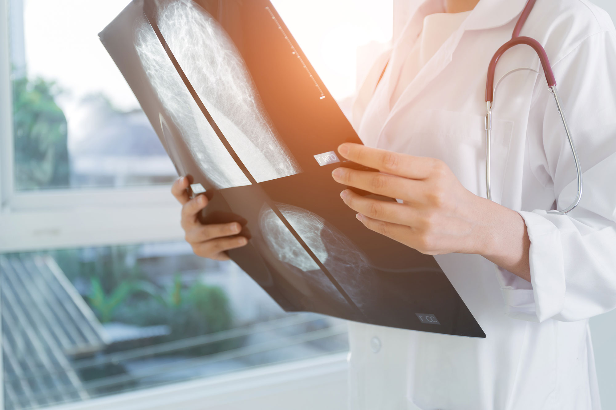 Mammogram