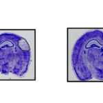 Left image: In this image, the researchers used a molecule called Gap19 to block the hemichannels, which resulted in smaller stroke damage. 

Right image: This image shows the size of a stroke in a mouse’s brain without treatment by Gap19.