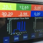 UBC students design low-cost ventilator for COVID-19