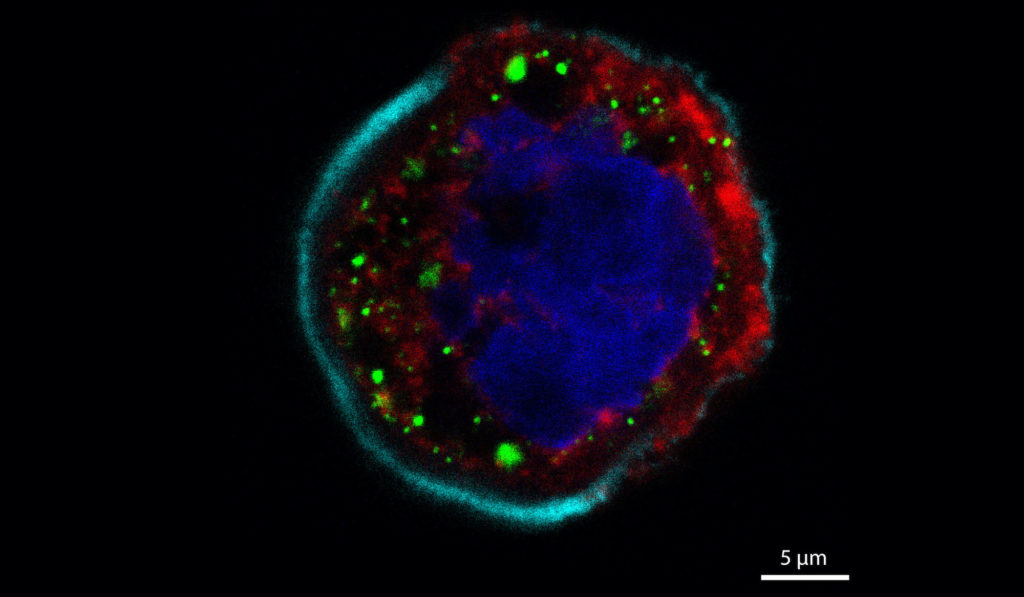 SARS-CoV-2 B.1.1.7, also called the UK variant. The green depicts viral DsRNA and red shows viral nucleocapsid protein – these are both viral biomarkers, and indicate that the cell shown is infected by SARS-CoV-2. Credit: Dr. Guang Gao, UBC LSI IMAGING