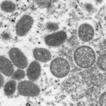 This electron microscopic (EM) image depicted a monkeypox virion, obtained from a clinical sample associated with the 2003 prairie dog outbreak. Credit: CDC/Cynthia S. Goldsmith, Russell Regnery
