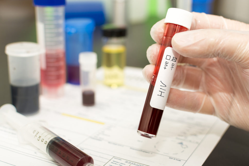 HIV - blood in a test tube