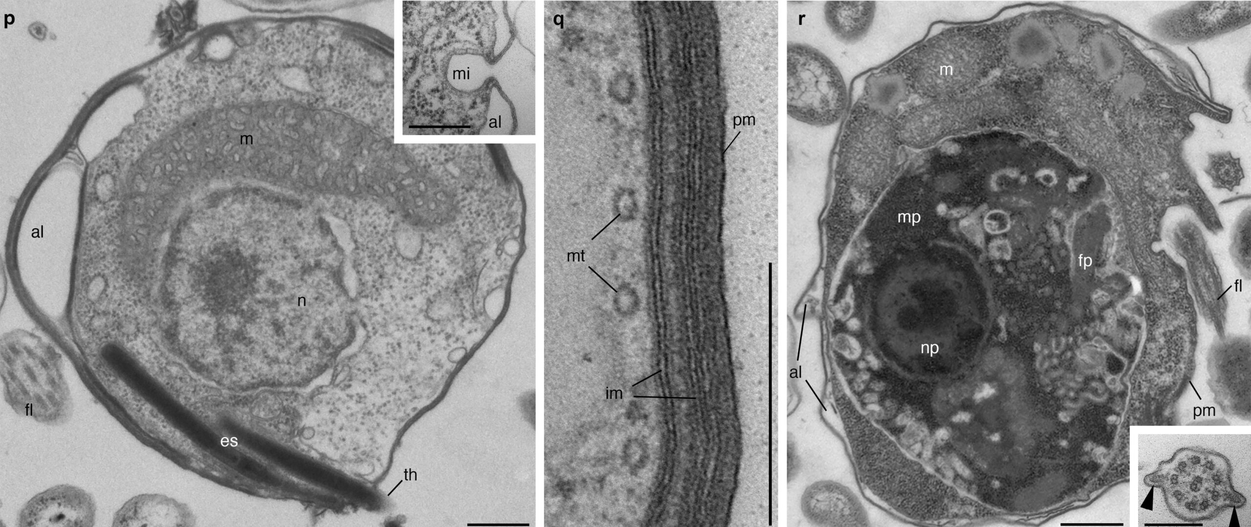 On the left is a starving provoran. On the right, it has engulfed its prey Photo Credit: Tikhonenkov, Mikhailov, Gawryluk, Belyaev, Mathur, Karpov, Zagumyonnyi, Borodina, Prokina, Mylnikov, Aleoshin, and Keeling, Nature