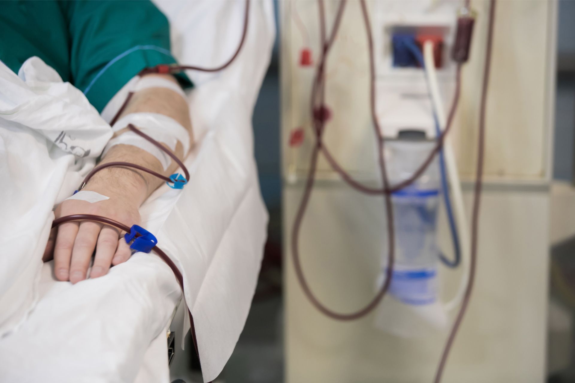 Patient undergoing dialysis with multiple tubes connected to a dialysis machine, lying in a hospital bed.